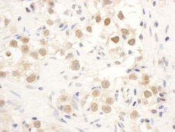 Chk1 Antibody, Novus Biologicals 0.1mg; Unlabeled:Antibodies, Polyclonal