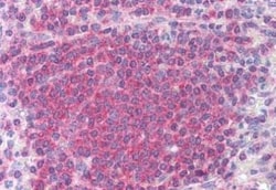 Chk2 Antibody (73C175.1.1), Novus Biologicals 0.1mg; Unlabeled:Antibodies,