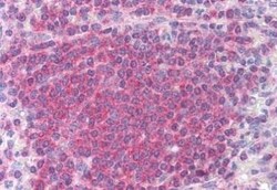 Chk2 Antibody (73C175.1.1), Novus Biologicals 0.1mg; Unlabeled:Antibodies,