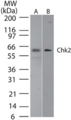 Chk2 Antibody (73C175.1.1), Novus Biologicals 0.1mg; Unlabeled:Antibodies,