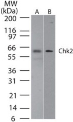 Chk2 Antibody (73C175.1.1), Novus Biologicals 0.1mg; Unlabeled:Antibodies,