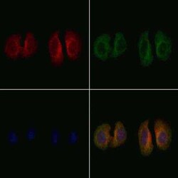Cholecystokinin Antibody, Novus Biologicals 100 &mu;g; Unconjugated:Antibodies,