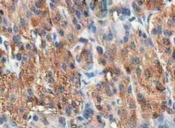 Cholecystokinin Antibody, Novus Biologicals 100 &mu;g; Unconjugated:Antibodies,