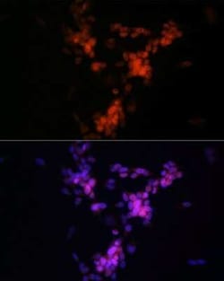 Choline Acetyltransferase/ChAT Rabbit anti-Human, Clone: 1I4V0, Novus Biologicals:Antibodies:Primary
