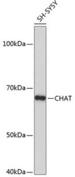 Choline Acetyltransferase/ChAT Rabbit anti-Human, Clone: 1I4V0, Novus Biologicals:Antibodies:Primary