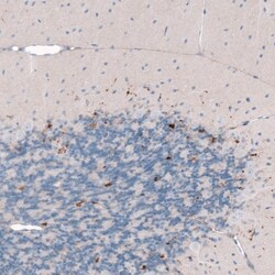 Choline Acetyltransferase/ChAT Antibody, Novus Biologicals 0.1mL; Unlabeled:Antibodies,