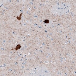 Choline Acetyltransferase/ChAT Antibody, Novus Biologicals 0.1mL; Unlabeled:Antibodies,