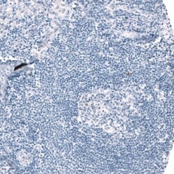 Choline Acetyltransferase/ChAT Antibody, Novus Biologicals 0.1mL; Unlabeled:Antibodies,
