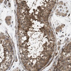 Choline Kinase beta Antibody, Novus Biologicals:Antibodies:Primary Antibodies
