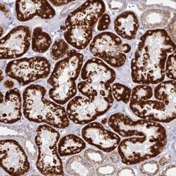 Choline dehydrogenase Antibody, Novus Biologicals 0.1mL; Unlabeled:Antibodies,