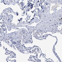 Choline dehydrogenase Antibody, Novus Biologicals:Antibodies:Primary Antibodies