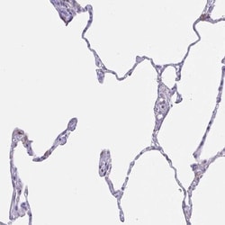 Choline dehydrogenase Antibody, Novus Biologicals 0.1mL; Unlabeled:Antibodies,