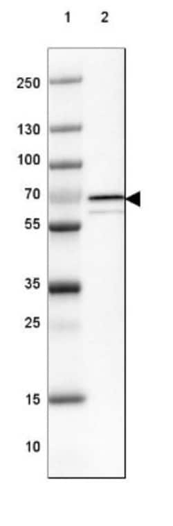 Choline dehydrogenase Antibody, Novus Biologicals:Antibodies:Primary Antibodies