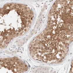 Choline kinase alpha Antibody, Novus Biologicals 25 &mu;L; Unlabeled:Antibodies,