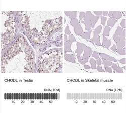 Chondrolectin Antibody, Novus Biologicals 0.1mL; Unlabeled:Antibodies,