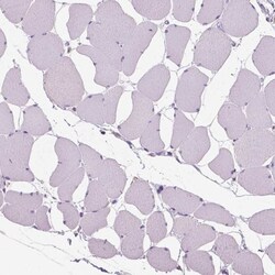 Chondrolectin Antibody, Novus Biologicals 0.1mL; Unlabeled:Antibodies,