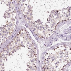 Chondrolectin Antibody, Novus Biologicals 0.1mL; Unlabeled:Antibodies,