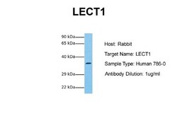 Chondromodulin-1/LECT1 Antibody, Novus Biologicals 0.05mg; Unlabeled:Antibodies,