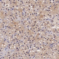 Chordin-like 1/CHRDL1 Antibody, Novus Biologicals 0.1mL; Unlabeled:Antibodies,