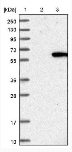 Chordin-like 1/CHRDL1 Antibody, Novus Biologicals 0.1mL; Unlabeled:Antibodies,
