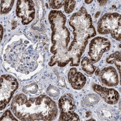 Chorein Antibody, Novus Biologicals 25 &mu;L | Buy Online | Novus Biologicals | Fisher Scientific