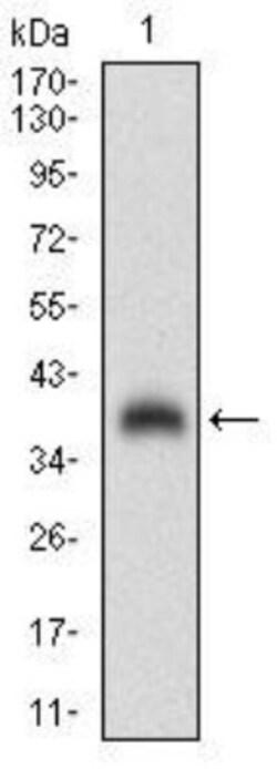 Chorionic Gonadotropin alpha Chain (hCG alpha) Antibody (2E6B3) - BSA Free,