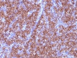 Chromogranin A Antibody (CGA/413), Novus Biologicals 0.2mg; Unlabeled:Antibodies,