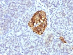 Chromogranin A Antibody (CGA/413 + CHGA/777 + CHGA/798), Novus Biologicals