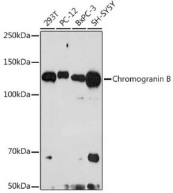 Chromogranin B Rabbit anti-Human, Mouse, Rat, Clone: 5N6T1, Novus Biologicals 20 &mu;g | Buy Online | Novus Biologicals | Fisher Scientific