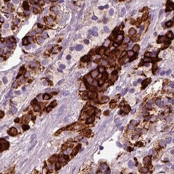 Chromogranin B Antibody, Novus Biologicals:Antibodies:Primary Antibodies