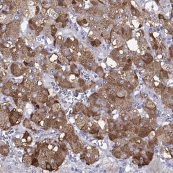 Chromogranin C Antibody, Novus Biologicals 0.1mL; Unlabeled:Antibodies,