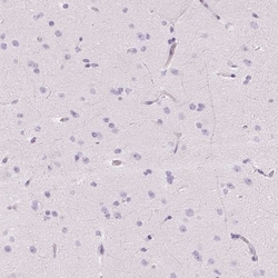 Chymase/CMA1/Mast Cell Chymase Antibody, Novus Biologicals 25 &mu;L, Unlabeled:Antibodies,