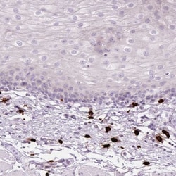 Chymase/CMA1/Mast Cell Chymase Antibody, Novus Biologicals 25 &mu;L, Unlabeled:Antibodies,