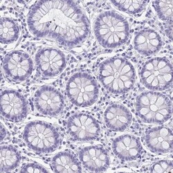Chymotrypsin C/CTRC Antibody, Novus Biologicals 25ul | Buy Online | Novus Biologicals | Fisher Scientific