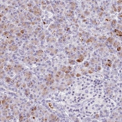 Chymotrypsin C/CTRC Antibody, Novus Biologicals 25ul | Buy Online | Novus Biologicals | Fisher Scientific