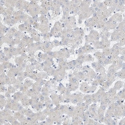 Chymotrypsin-like protease Antibody, Novus Biologicals 0.1mL; Unlabeled:Antibodies,