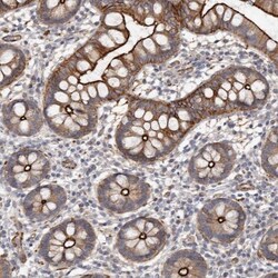 Cingulin Antibody, Novus Biologicals 0.1mL; Unlabeled:Antibodies, Polyclonal