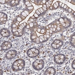 Cingulin Antibody, Novus Biologicals:Antibodies:Primary Antibodies