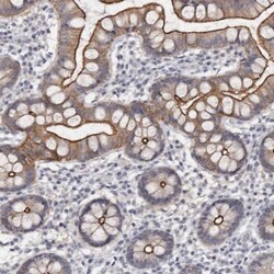 Cingulin Antibody, Novus Biologicals:Antibodies:Primary Antibodies
