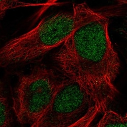 Citidine Deaminase Antibody, Novus Biologicals:Antibodies:Primary Antibodies