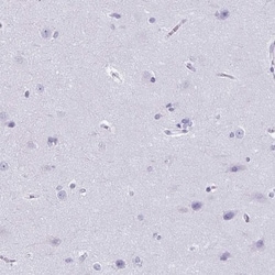 Citidine Deaminase Antibody, Novus Biologicals:Antibodies:Primary Antibodies