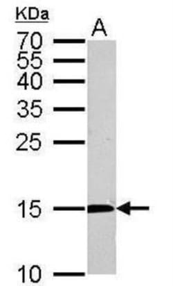 Citidine Deaminase Antibody, Novus Biologicals 0.1mg; Unlabeled:Antibodies,