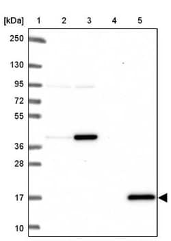 Citidine Deaminase Antibody, Novus Biologicals:Antibodies:Primary Antibodies