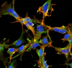Citrulline Antibody (2D3.1), Novus Biologicals 100&mu;g; Unlabeled:Antibodies,