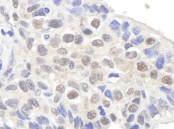 Claspin Antibody, Novus Biologicals 0.1mg; Unlabeled:Antibodies, Polyclonal