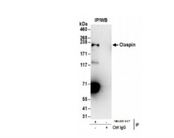 Claspin Antibody, Novus Biologicals 0.1mg; Unlabeled:Antibodies, Polyclonal