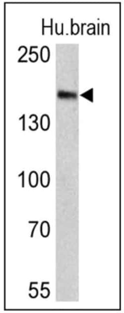 Clathrin Heavy Chain 1/CHC17 Antibody (X22) - BSA Free, Novus Biologicals