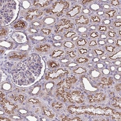 Clathrin light chain Antibody, Novus Biologicals:Antibodies:Primary Antibodies
