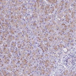 Clathrin light chain Antibody, Novus Biologicals:Antibodies:Primary Antibodies