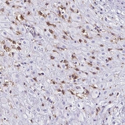 Clathrin light chain Antibody, Novus Biologicals:Antibodies:Primary Antibodies